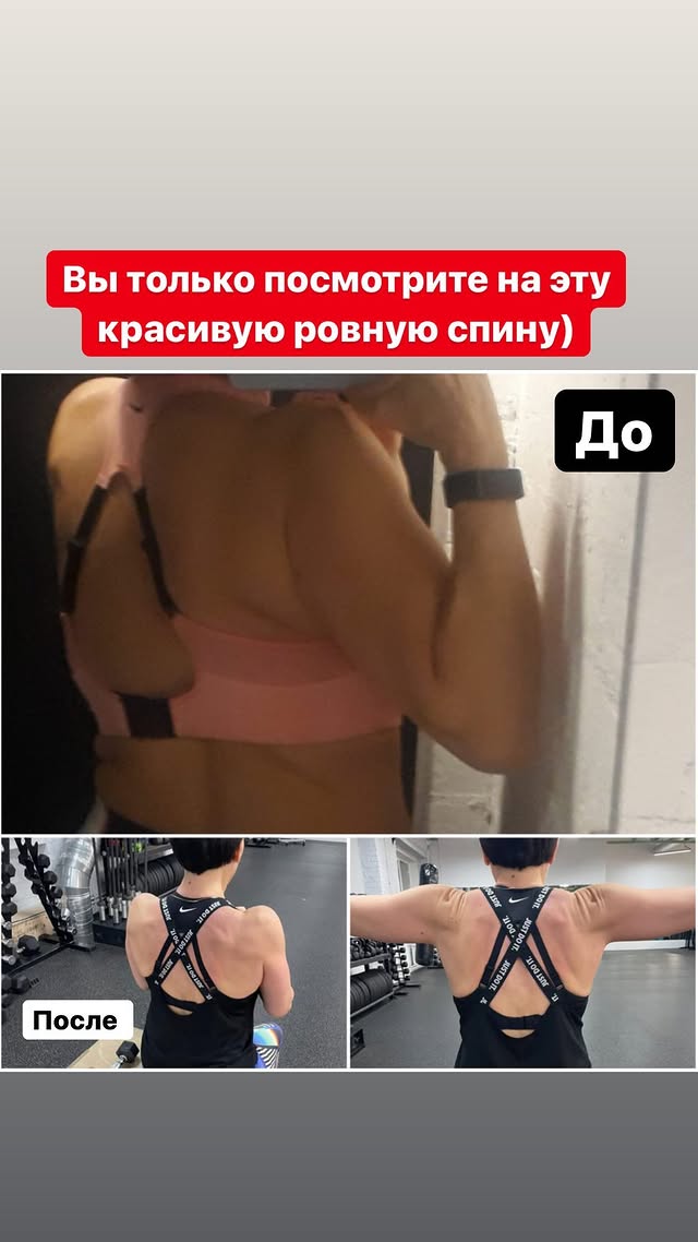 Работа со спиной. Фотографии до и после