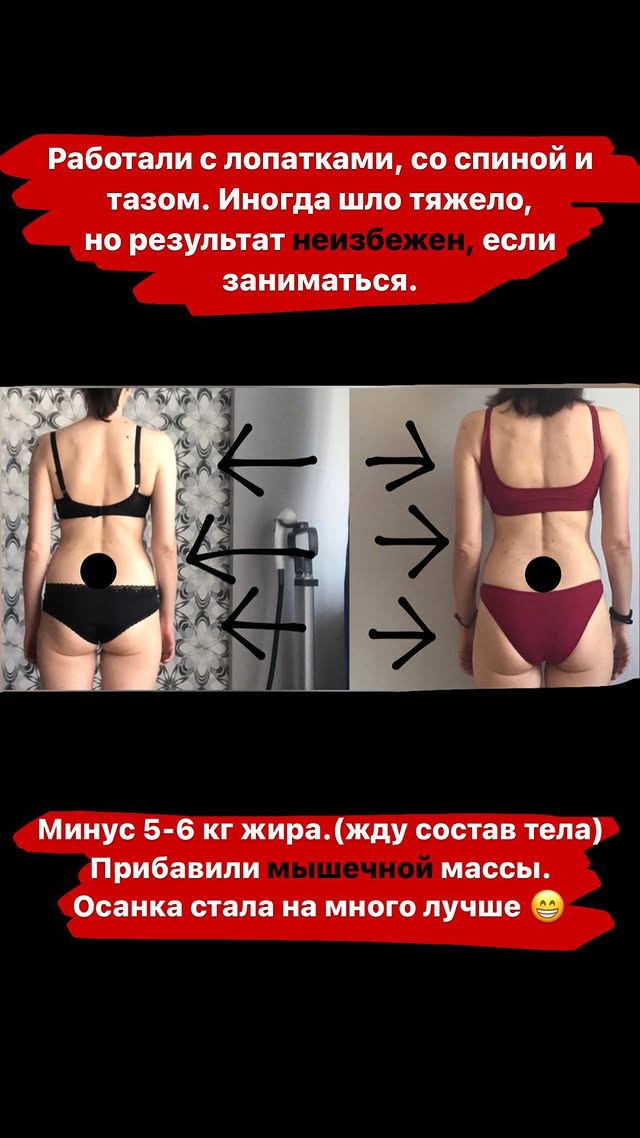 Работа над осанкой. Лопатки, спина и таз