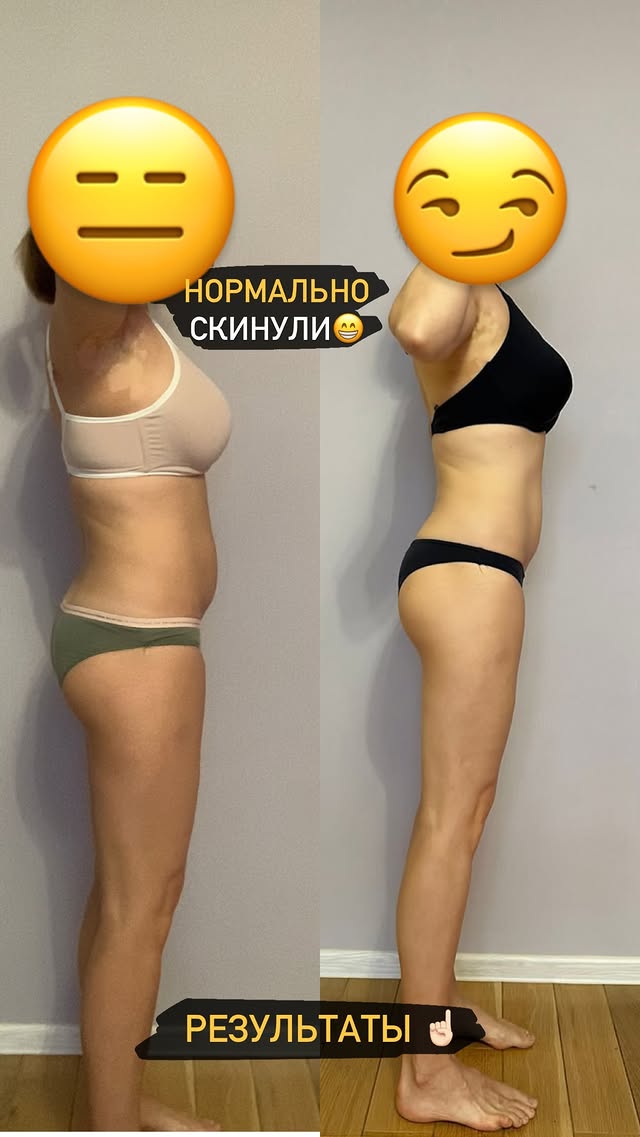Изменения формы. Фотографии в процессе работы